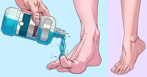3 fördelar som Listerine kan göra för dina fötter