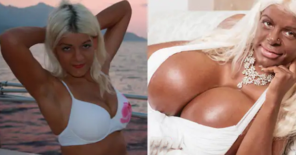 Martina har störst bröst i Europa – ”Jag ska bli en exotisk Barbie med mörk hud”