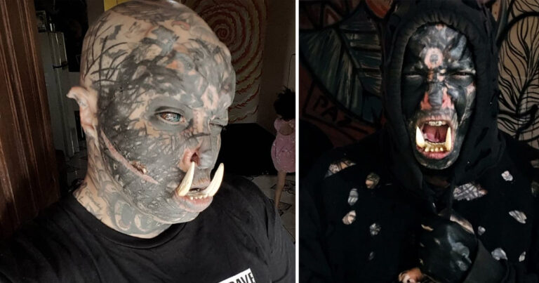 Han är besatt av tatueringar och operationer – har tatuerat ögonen och har betar i munnen