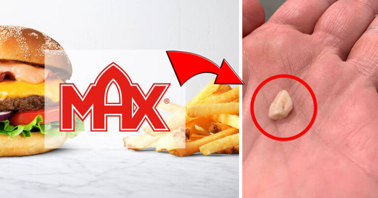 Elin gjorde ett vidrigt skräckfynd i Max-hamburgaren: ”Jag blev förbannad!”