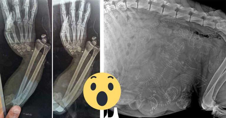 12 gånger läkare röntgade olika saker – resultatet är verkligen ett måste-se!