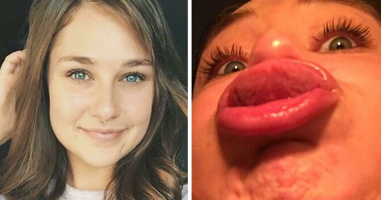 11 kvinnor som bjuder på sig själva – och det är verkligen hysteriskt roligt