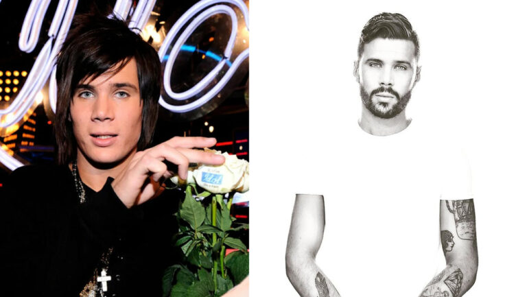 Robin Bengtsson avslöjande om skönhetsoperationen – avslöjar sanningen bakom hans förvandling